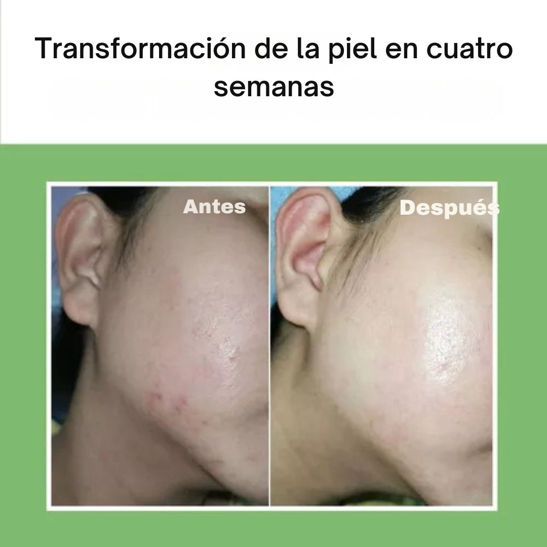 NONI Ampolla anti-arrugas