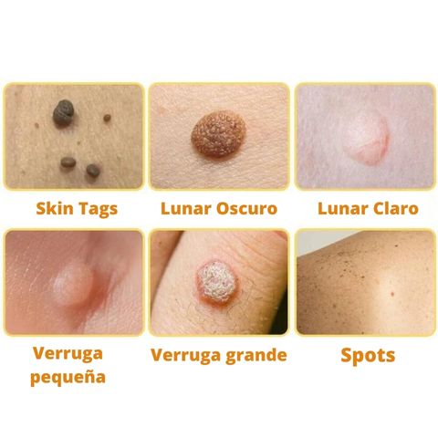 DERMABEE - Manchas en la piel