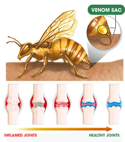 BEE VENOM - Alivio en las articulaciones