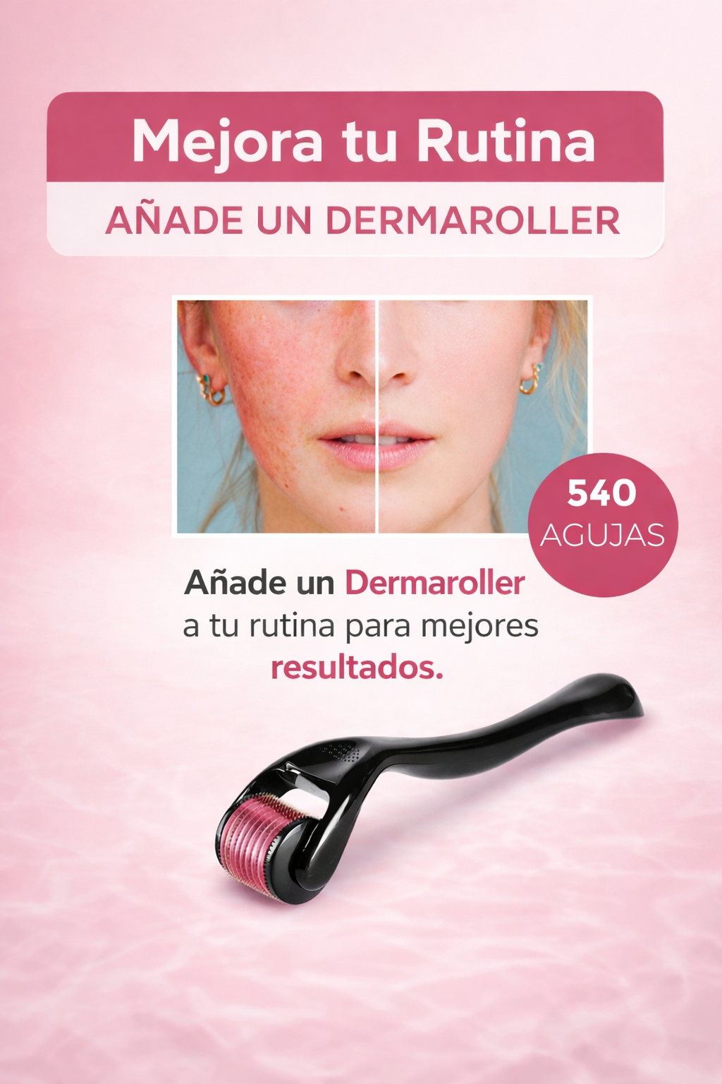 DERMAROLLER - completo perfecto para tu piel
