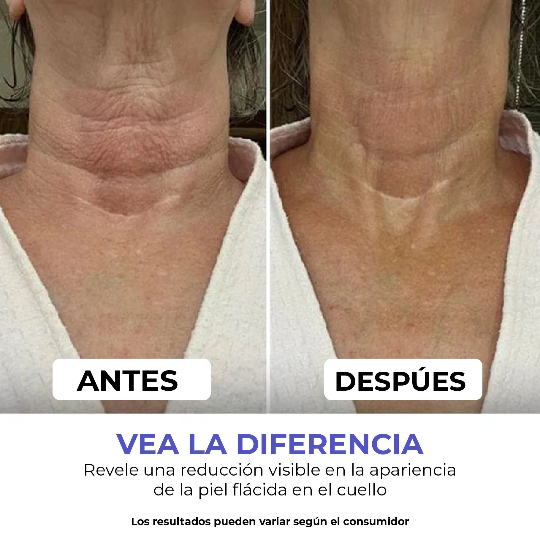 😍"CREMA REAFIRMANTE GOPURE: Reafirma, hidrata y rejuvenece tu piel"