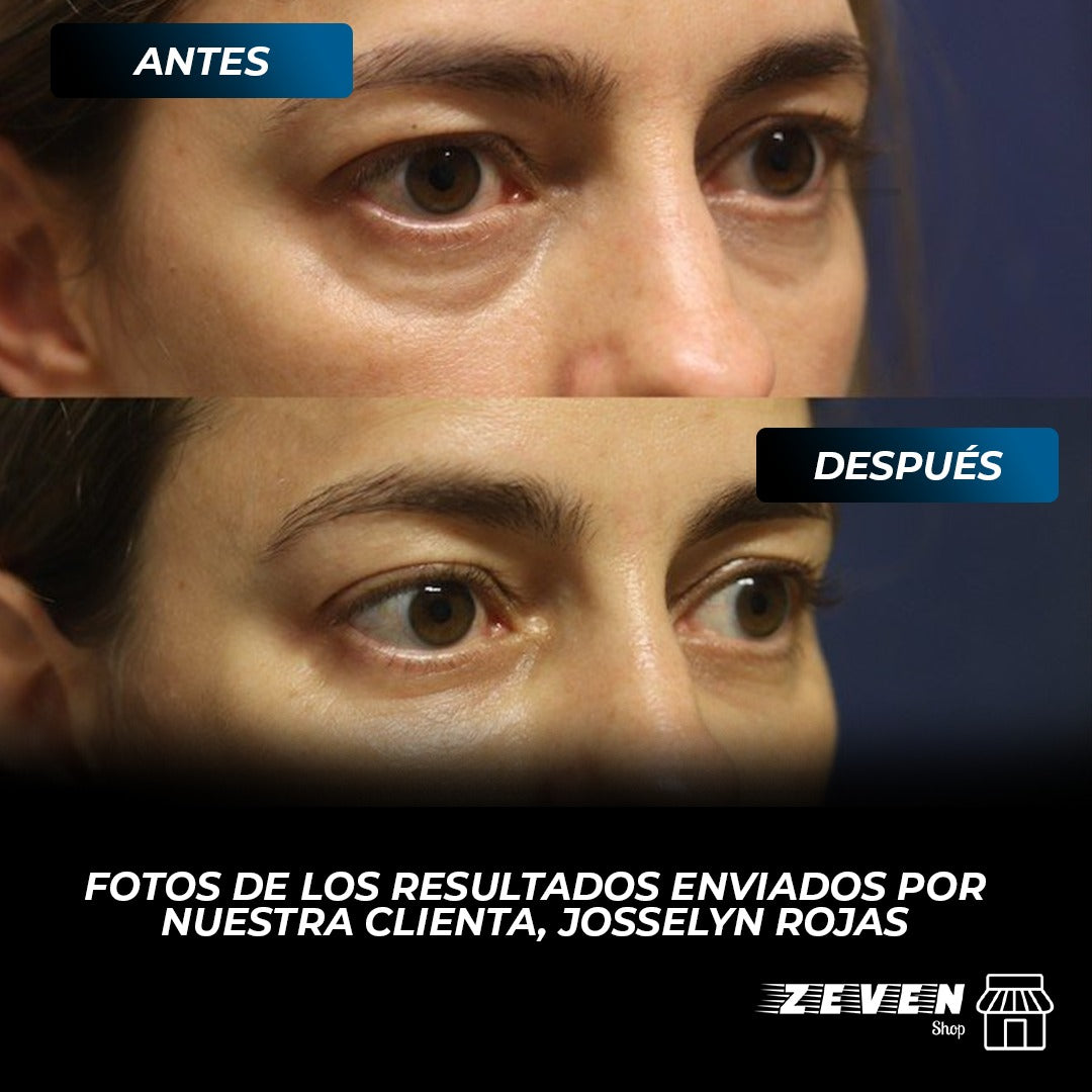 OPEN EYES™ NUEVA CREMA PARA OJOS