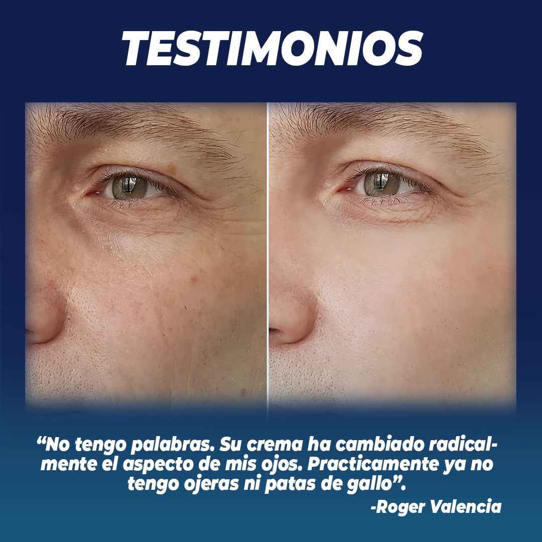 OPENEYES™ CREMA DE OJOS PARA HOMBRES