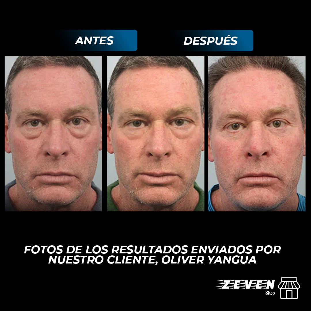 OPENEYES™ CREMA DE OJOS PARA HOMBRES