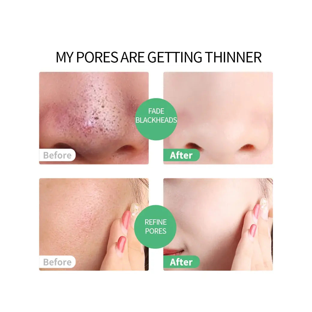 Mascarilla de aloe vera