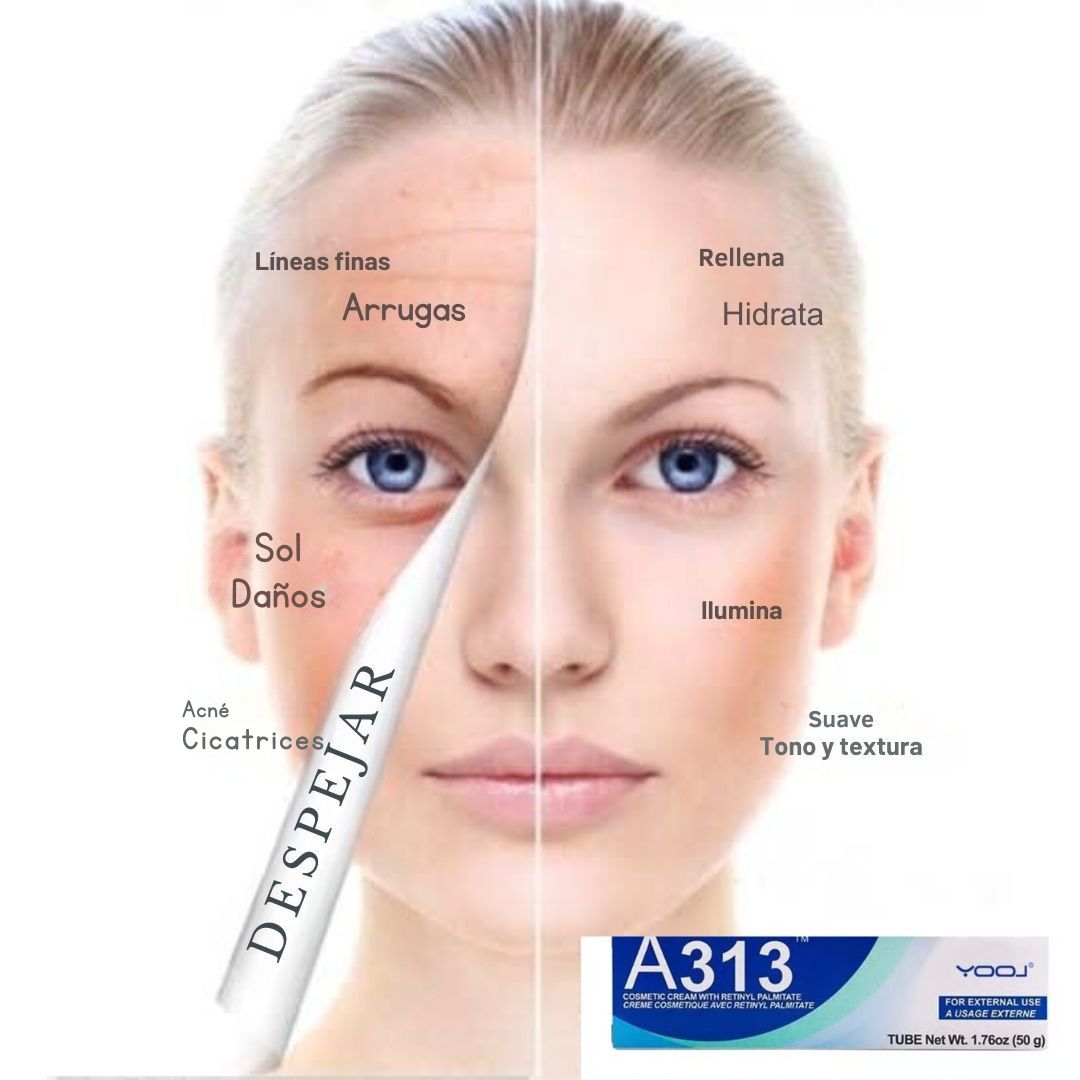 "A313: La Fórmula Perfecta de Retinol y Vitamina A para una Piel Radiante"